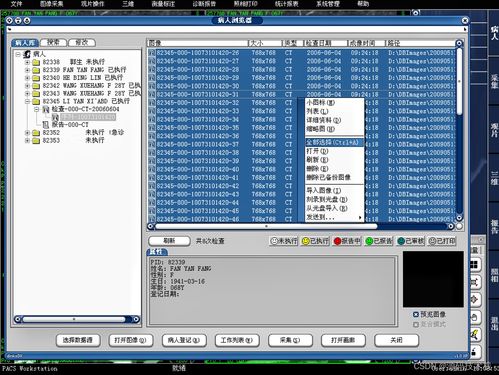 醫學影像信息系統(PACS)源碼基礎解析 架構、原理與數據處理服務
